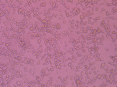 Following validation through diverse cell culture tests, the attachment rate of cells surpasses 90%, with the viability of attachment cells exceeding 95%